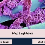 test quiz