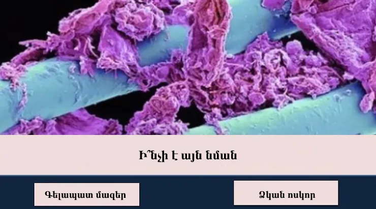 Test Quiz